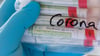 Proben für Corona-Tests werden untersucht. Foto: Hendrik Schmidt/dpa-Zentralbild/ZB/Symbolbild