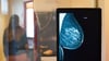 Röntgenbild eines Mammographie-Screening-Programms: Bei Frauen war Brustkrebs im Jahr 2016 die häufigste Krebserkrankung mit Todesfolge. Foto: Klaus-Dietmar Gabbert