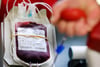 Blutkonserven werden zurzeit besonders dringend benötigt. Spenden müssen allerdings vorab online einen Termin vereinbaren.