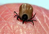 Eine Zecke auf menschlicher Haut. Die Spinnentiere können Borreliose oder FSME übertragen.