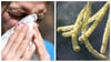 Nase und Augen sind bei Pollenallergikern besonders häufig betroffen.