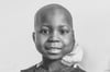 Der kleine Daniel aus Kamerun ist am Montag gestorben. Der Krebs hat ihn besiegt.