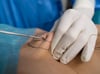 Kasse zahlt Lipödem-OP: Was das für Patientinnen bedeutet
